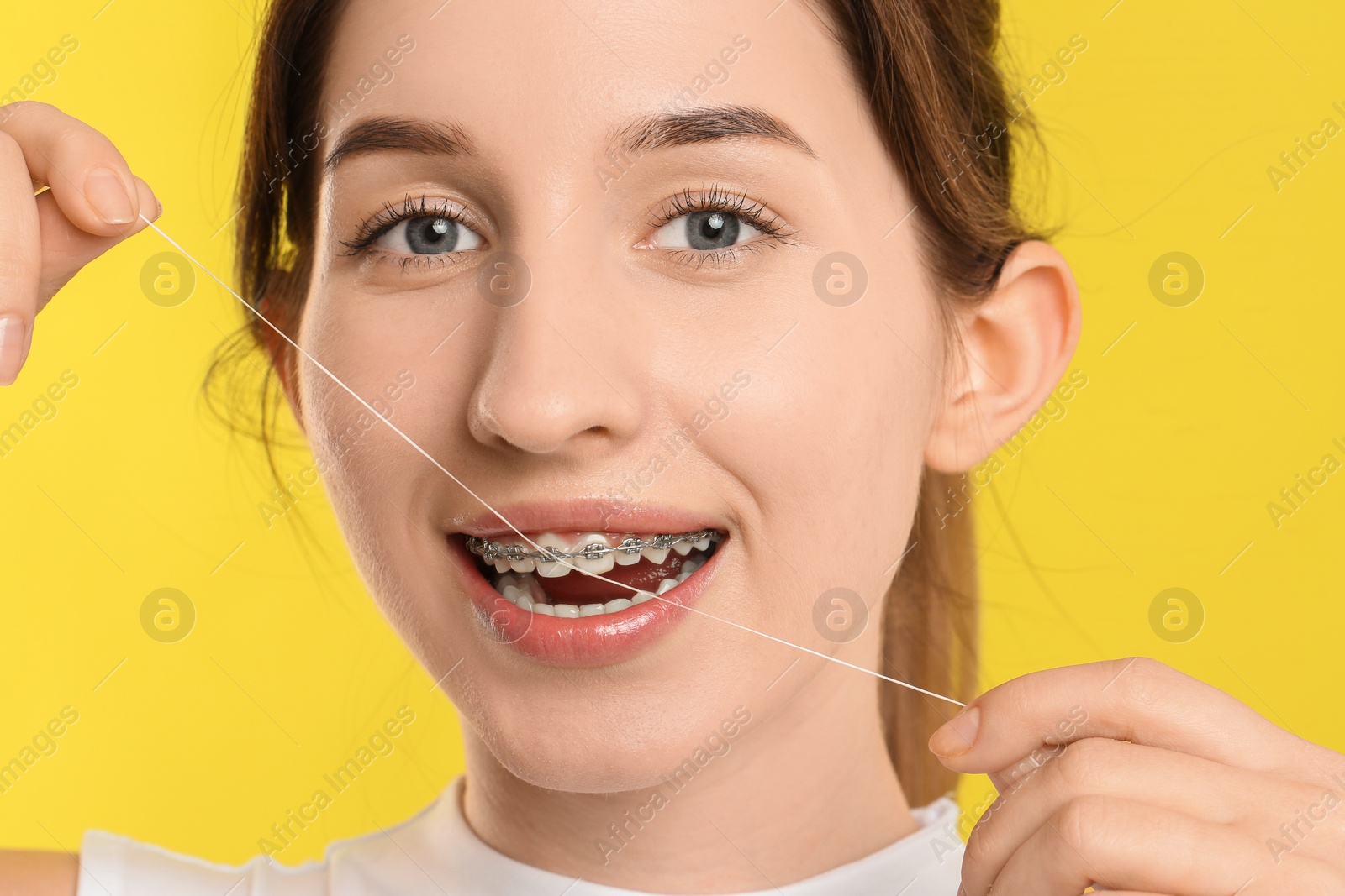 Photo of Smiling woman with braces cleaning teeth using dental floss on yellow background, closeup