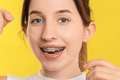 Photo of Smiling woman with braces cleaning teeth using dental floss on yellow background, closeup