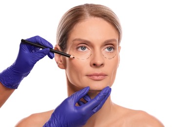 Photo of Doctor with pencil preparing patient for cosmetic surgery operation on white background, closeup