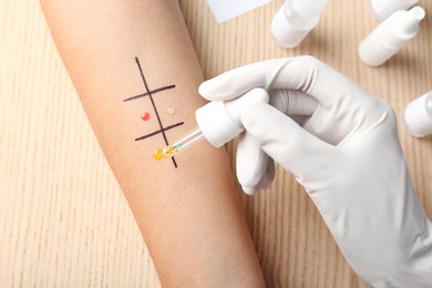 Photo of Doctor making allergy test at table, top view