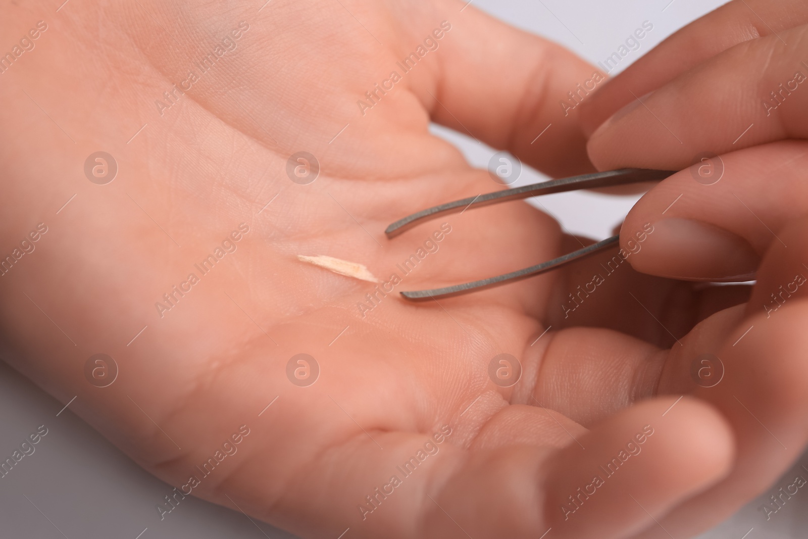 Photo of Woman pulling splinter from finger using tweezers on white background, closeup