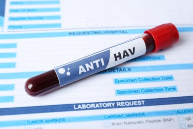 Photo of Tube with blood sample and label ANTI HAV on laboratory test form, closeup