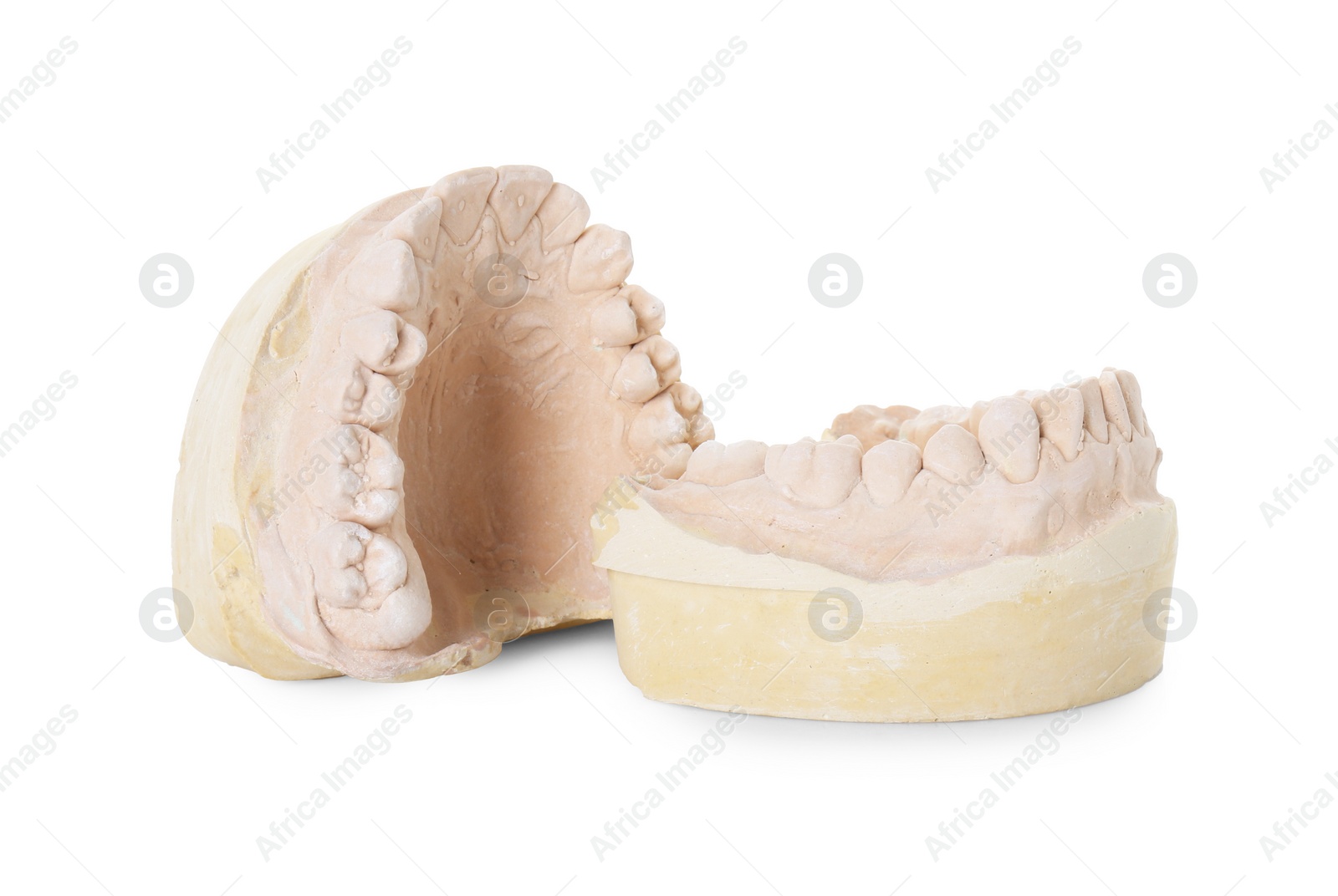 Photo of Dental model with jaws isolated on white. Cast of teeth