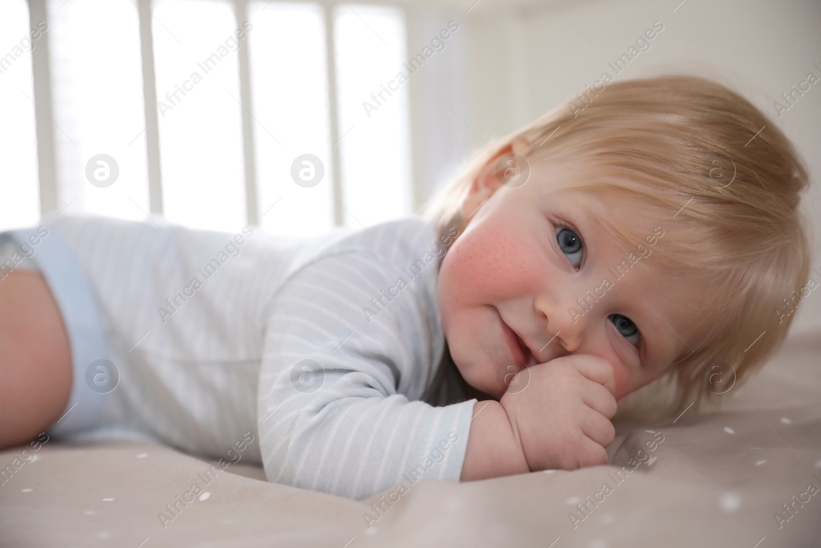 Image of Cute little baby with allergy symptoms on cheeks  at home