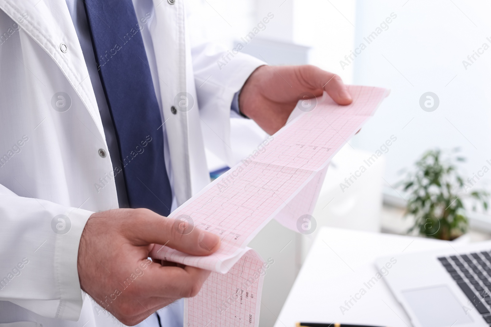 Photo of Doctor examining cardiogram in medical clinic, closeup