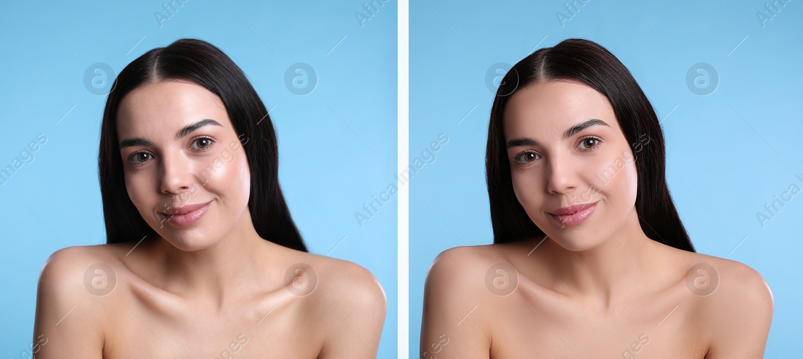 Image of Collage with photos of beautiful young woman before and after using mattifying wipes on light blue background. Banner design