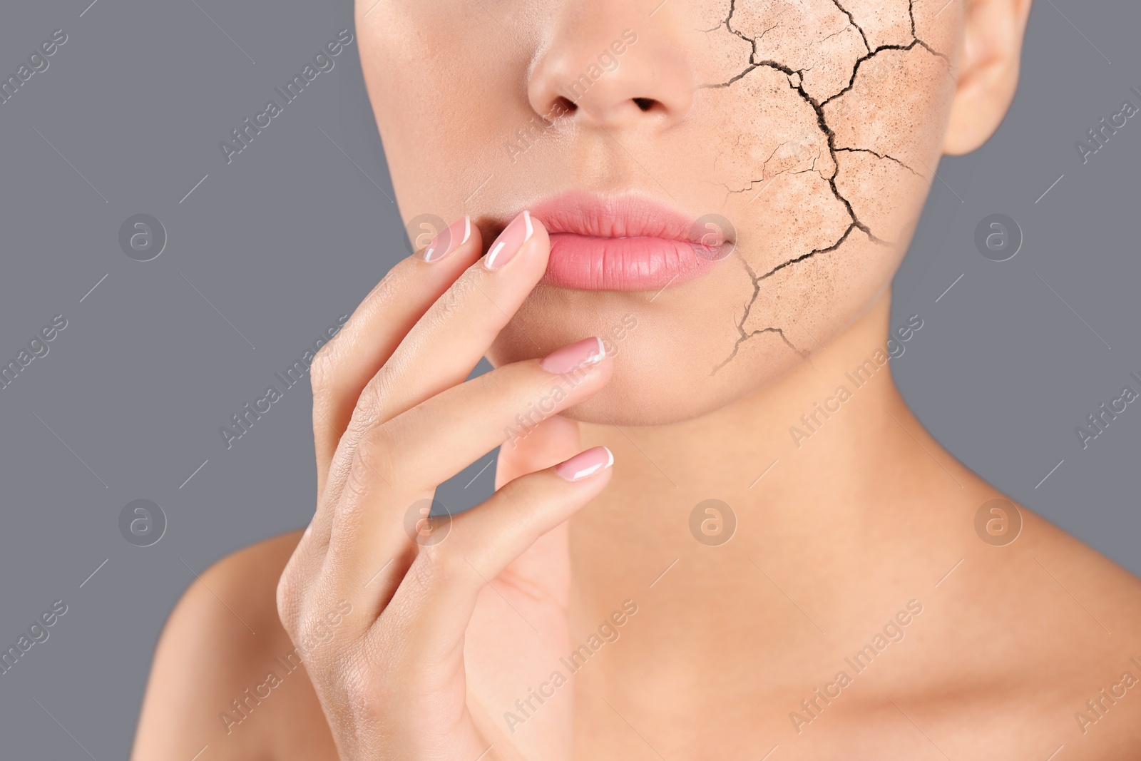 Image of Beautiful young woman with dry skin on grey background