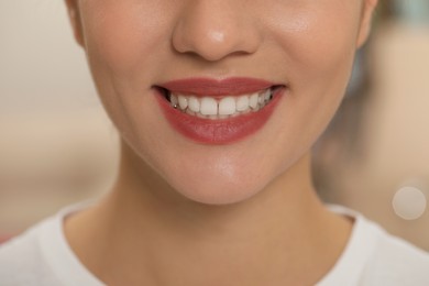 Photo of Happy young woman with white teeth, closeup