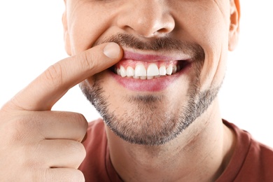 Smiling man showing teeth on white background, closeup