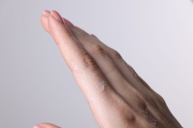 Woman with dry skin on hand against light background, macro view