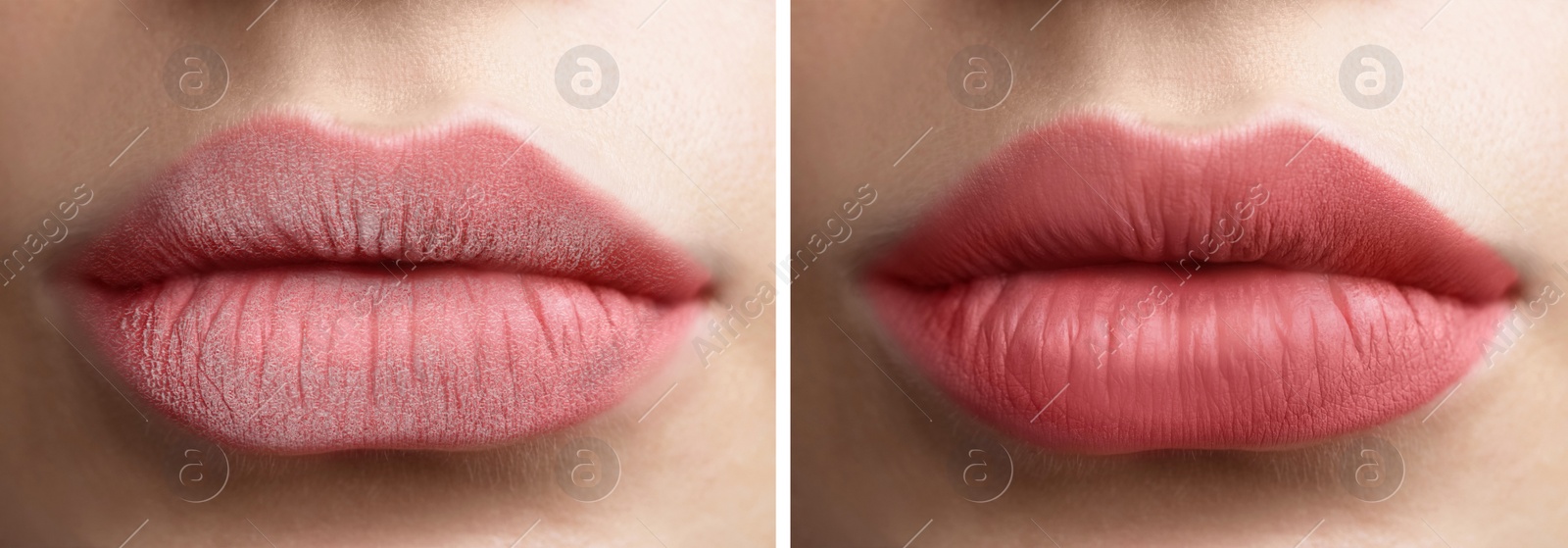 Image of Collage with photos of woman with dry and moisturized lips, closeup. Banner design