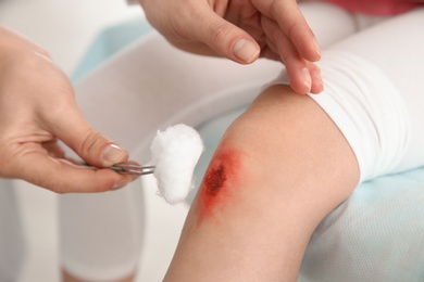 Photo of Female doctor cleaning little girl's leg injury in clinic, closeup. First aid