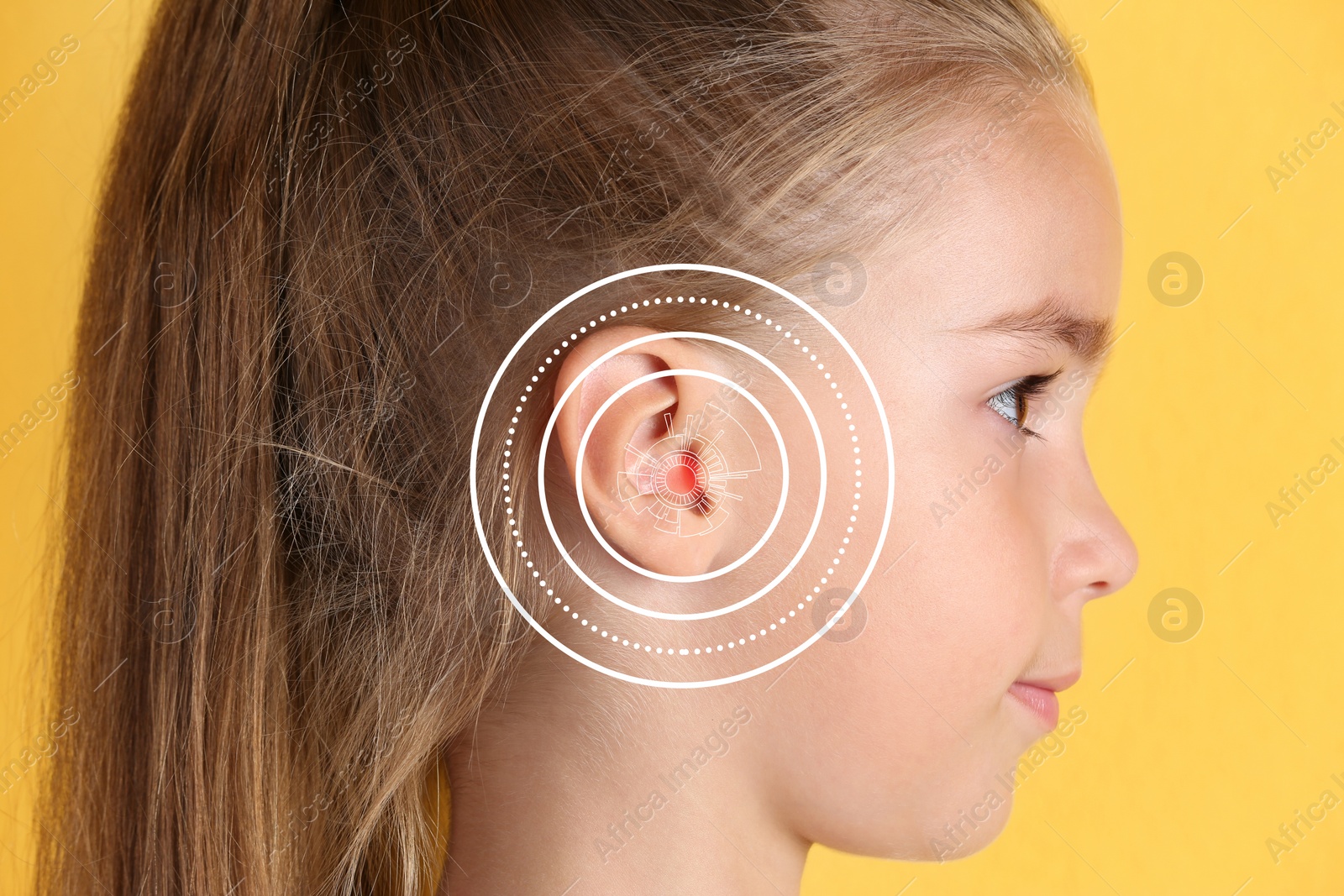 Image of Cute little girl with hearing problem on yellow background, closeup