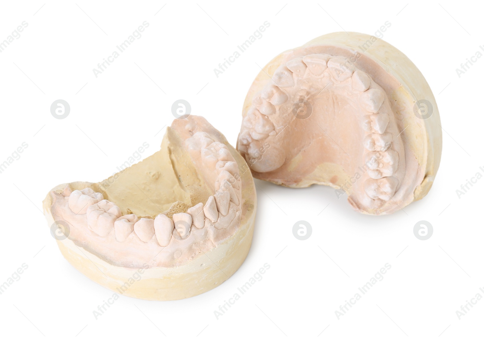 Photo of Dental model with jaws isolated on white. Cast of teeth