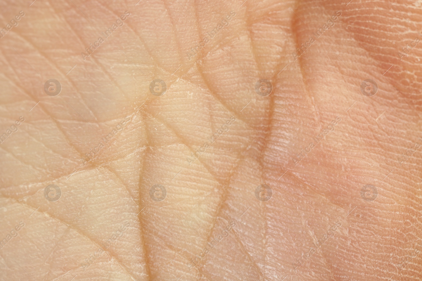 Photo of Texture of dry skin as background, macro view