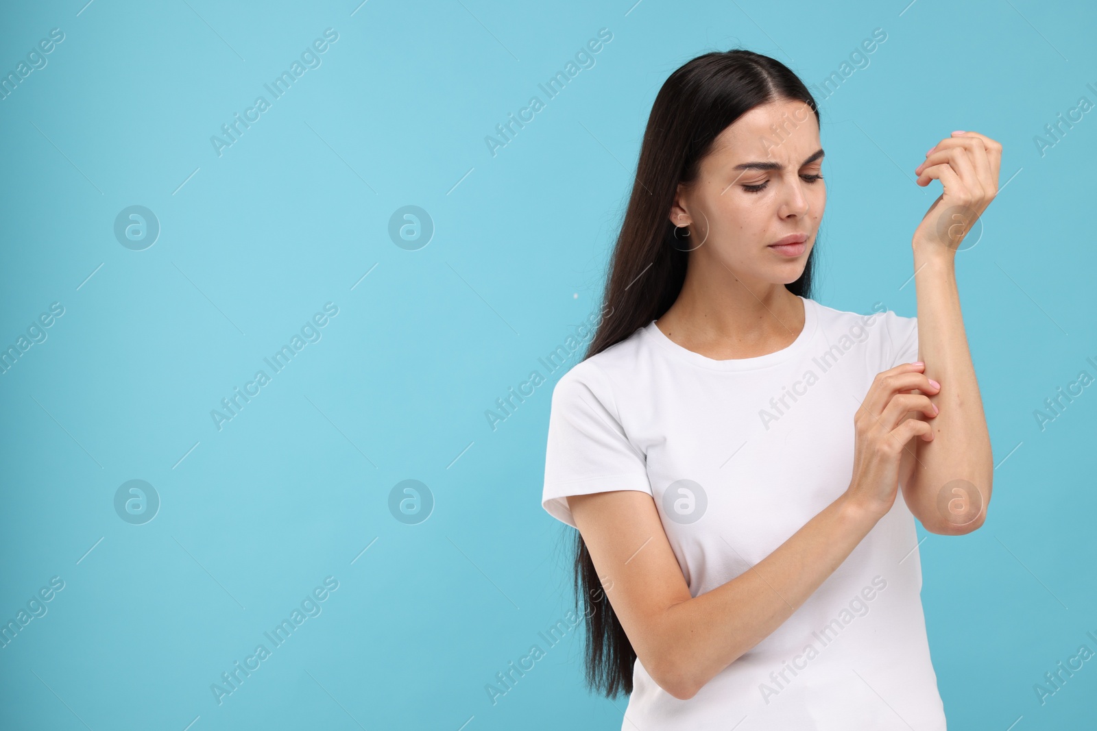 Photo of Suffering from allergy. Young woman scratching her arm on light blue background. Space for text