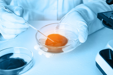 Image of Scientist taking blood sample from Petri dish with pipette, closeup. Laboratory analysis