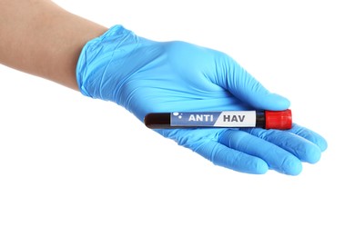 Photo of Scientist holding tube with blood sample and label Anti HAV on white background, closeup
