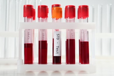Photo of Tubes with blood samples in rack on white background. STD test