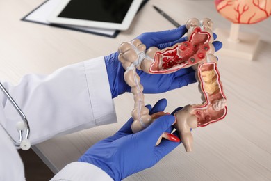 Gastroenterologist with human colon model at table, closeup