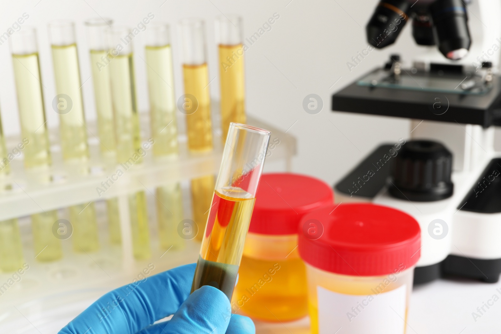 Photo of Nurse holding tube with urine sample for analysis in laboratory, closeup