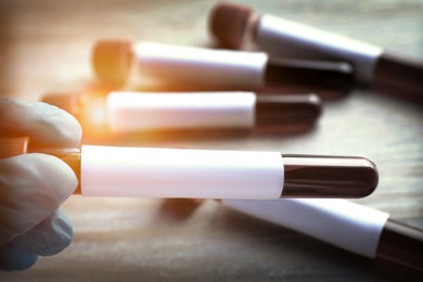 Image of Laboratory worker holding test tube with blood sample over table, closeup