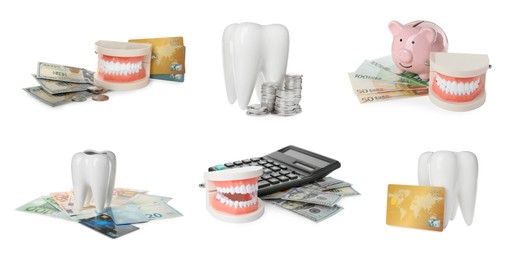 Image of Set with educational dental models and money on white background, banner design. Expensive teeth treatment