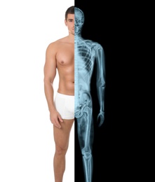 Image of Man in underwear, half x-ray photograph. Medical check