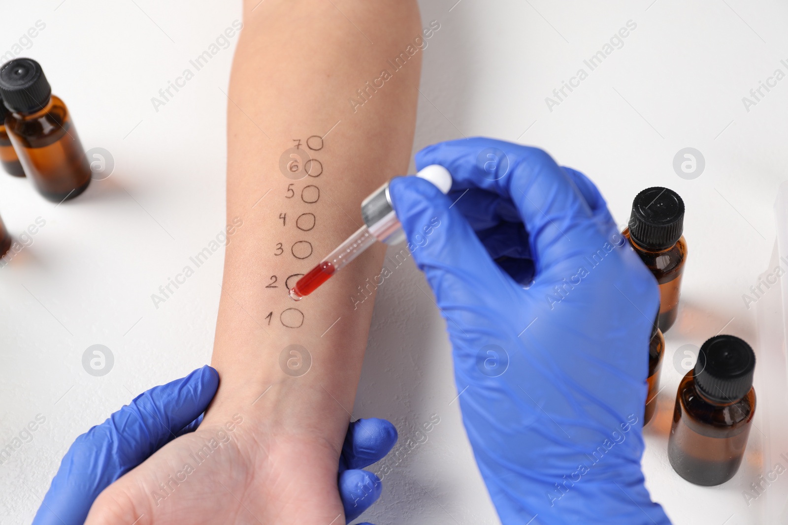 Photo of Doctor doing skin allergy test at light table, closeup