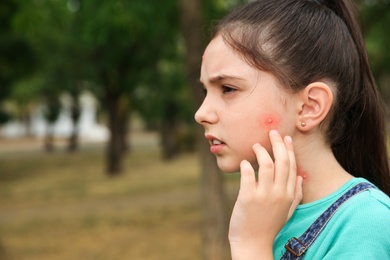 Photo of Girl touching cheek with insect bite in park. Space for text