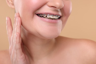 Photo of Smiling woman with dental braces on beige background, closeup