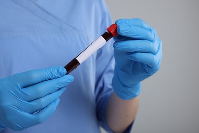 Laboratory testing. Doctor with blood sample in tube on light grey background, closeup