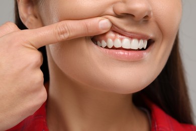 Woman showing her clean teeth on light grey background, closeup