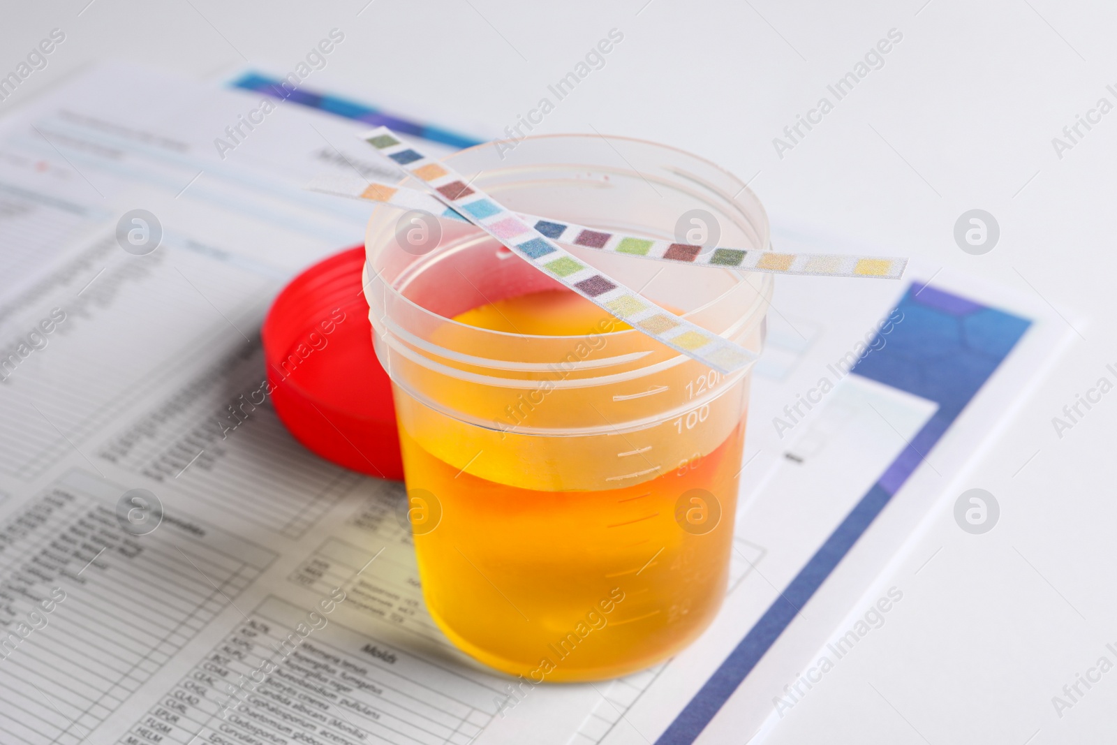 Photo of Container with urine sample for analysis and test strips on white table, closeup