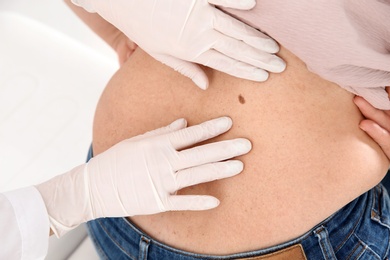 Dermatologist examining mature patient's birthmark in clinic, closeup