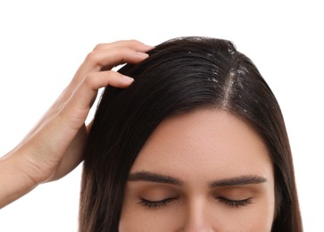Photo of Woman examining her hair and scalp on white background, closeup. Dandruff problem