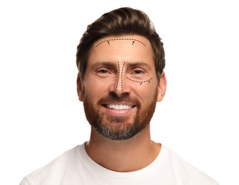 Man with markings for cosmetic surgery on his face against white background