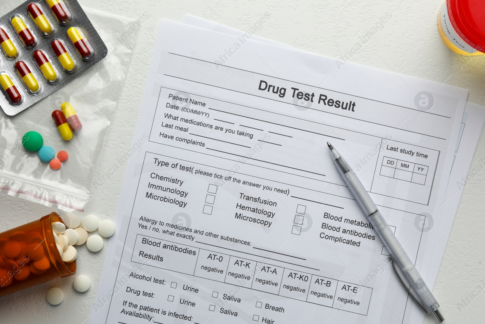 Photo of Drug test result form, pills, container with urine sample and pen on light table, flat lay