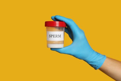 Photo of Scientist holding container with sperm on yellow background, closeup