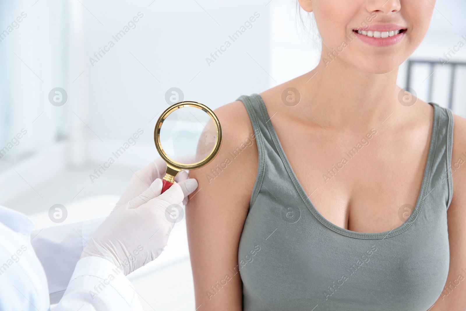 Photo of Dermatologist examining patient's birthmark with magnifying glass in clinic, closeup