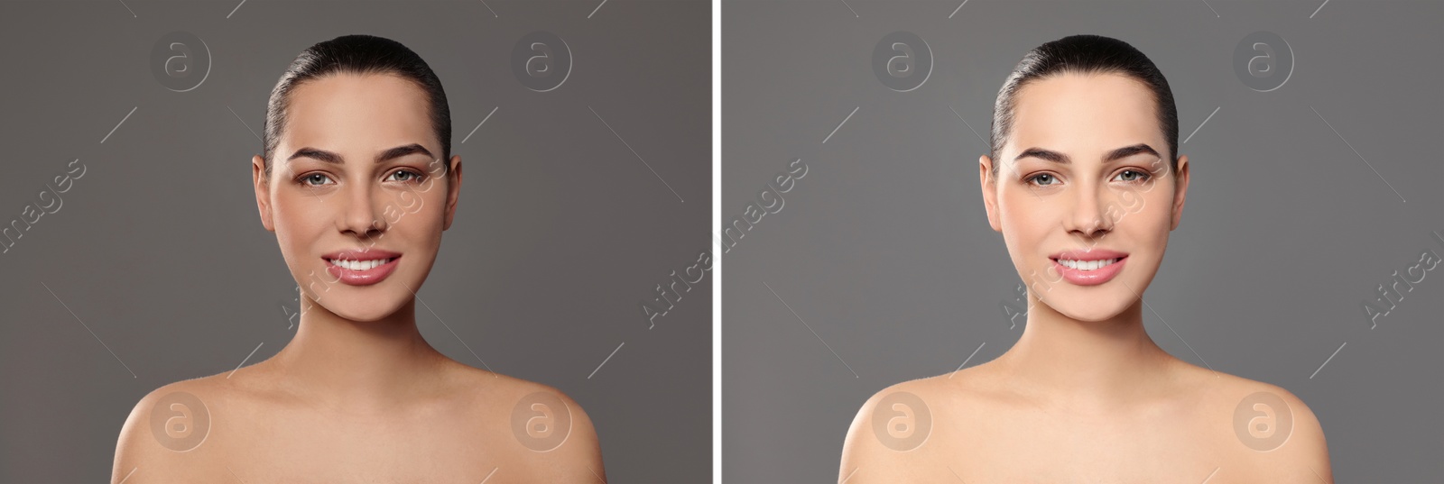 Image of Collage with photos of beautiful young woman before and after indoor tanning on grey background. Banner design