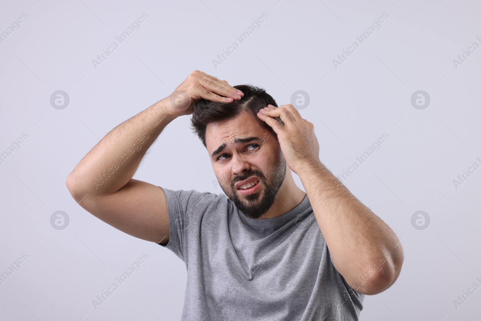 Photo of Emotional man examining his head on light grey background. Dandruff problem