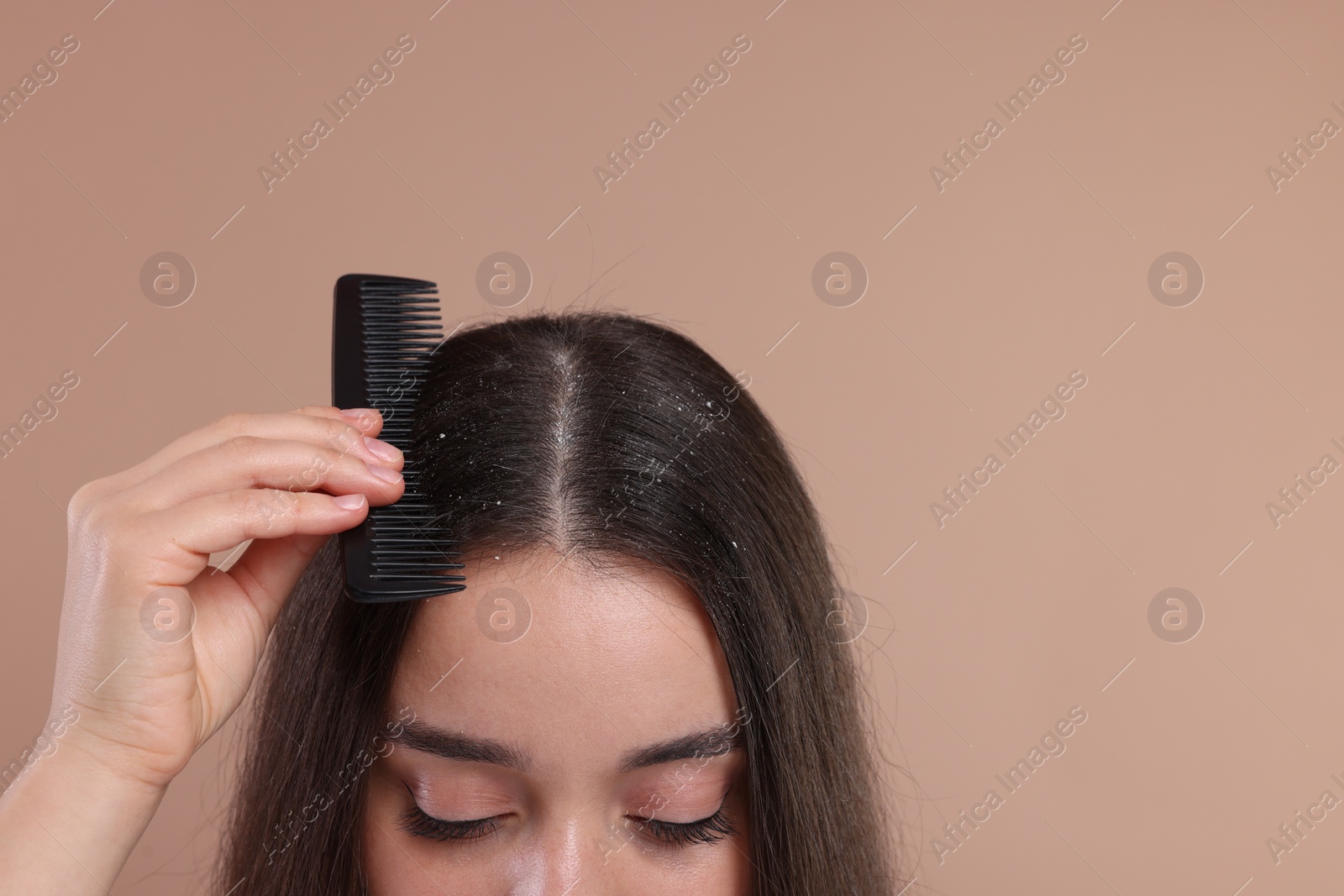 Photo of Woman with comb examining her hair and scalp on beige background, closeup with space for text. Dandruff problem