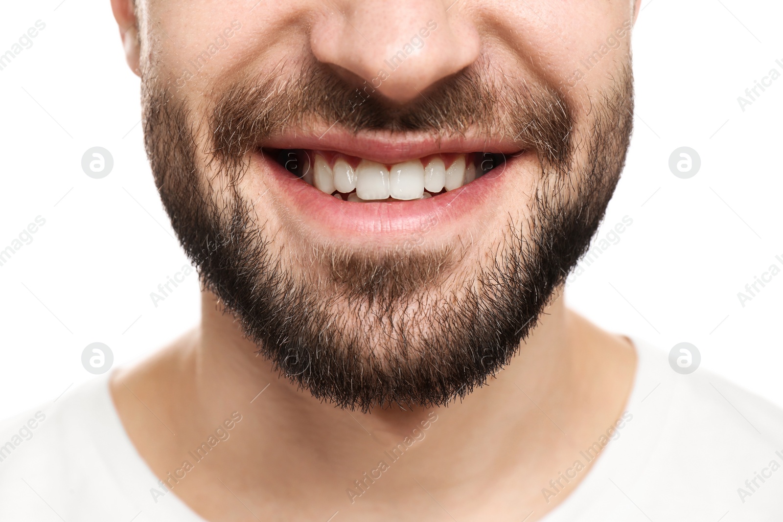 Photo of Young man with beautiful smile on white background. Teeth whitening