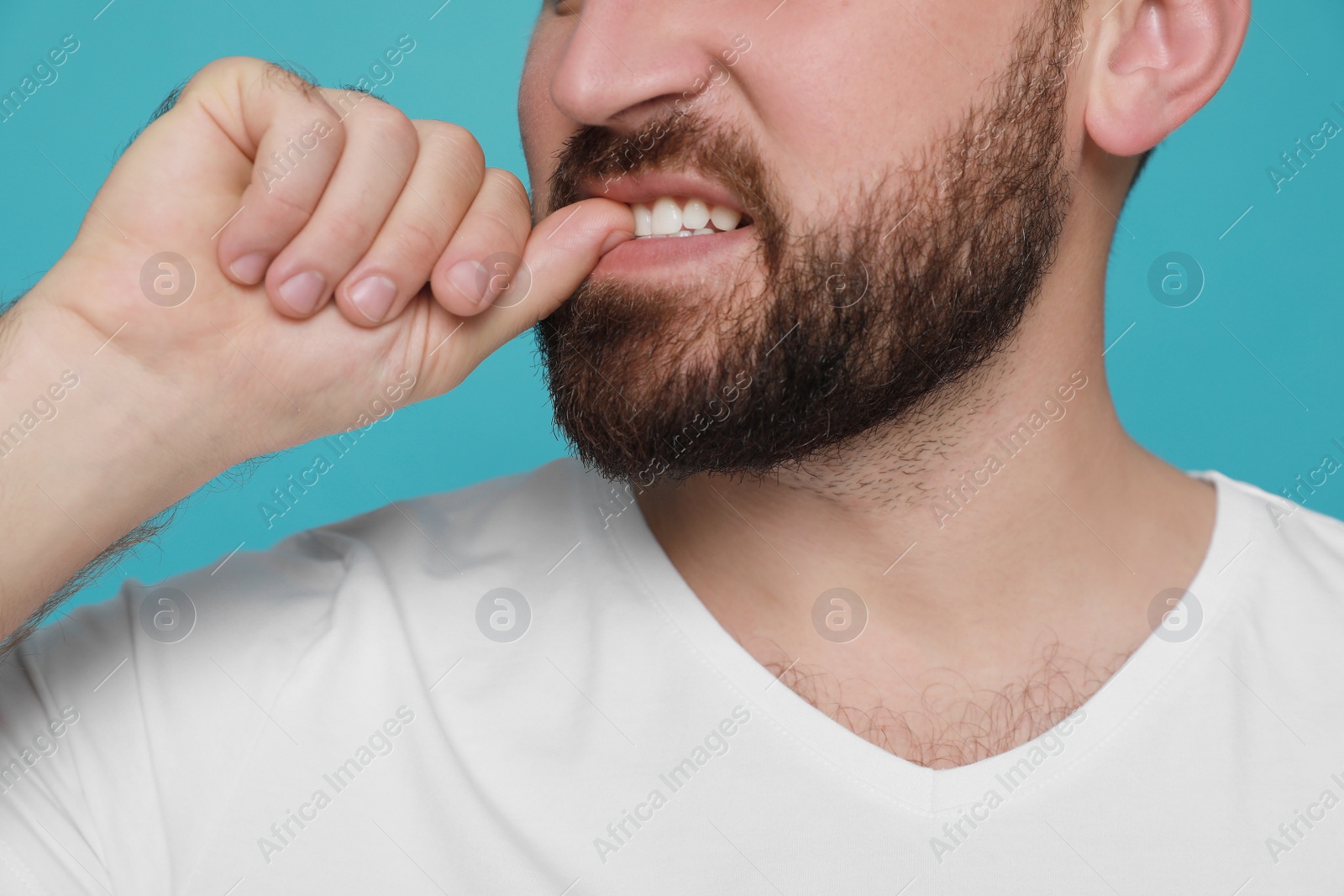 Photo of Man biting his nails on light blue background, closeup. Bad habit