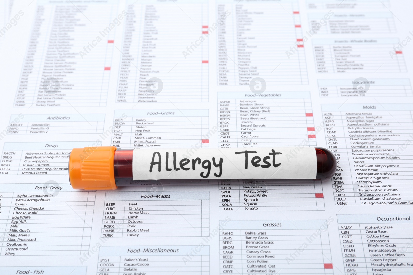 Photo of Glass tube with blood on document. Allergy test