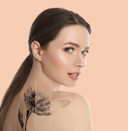 Image of Design with photowoman on beige background during tattoo removal process