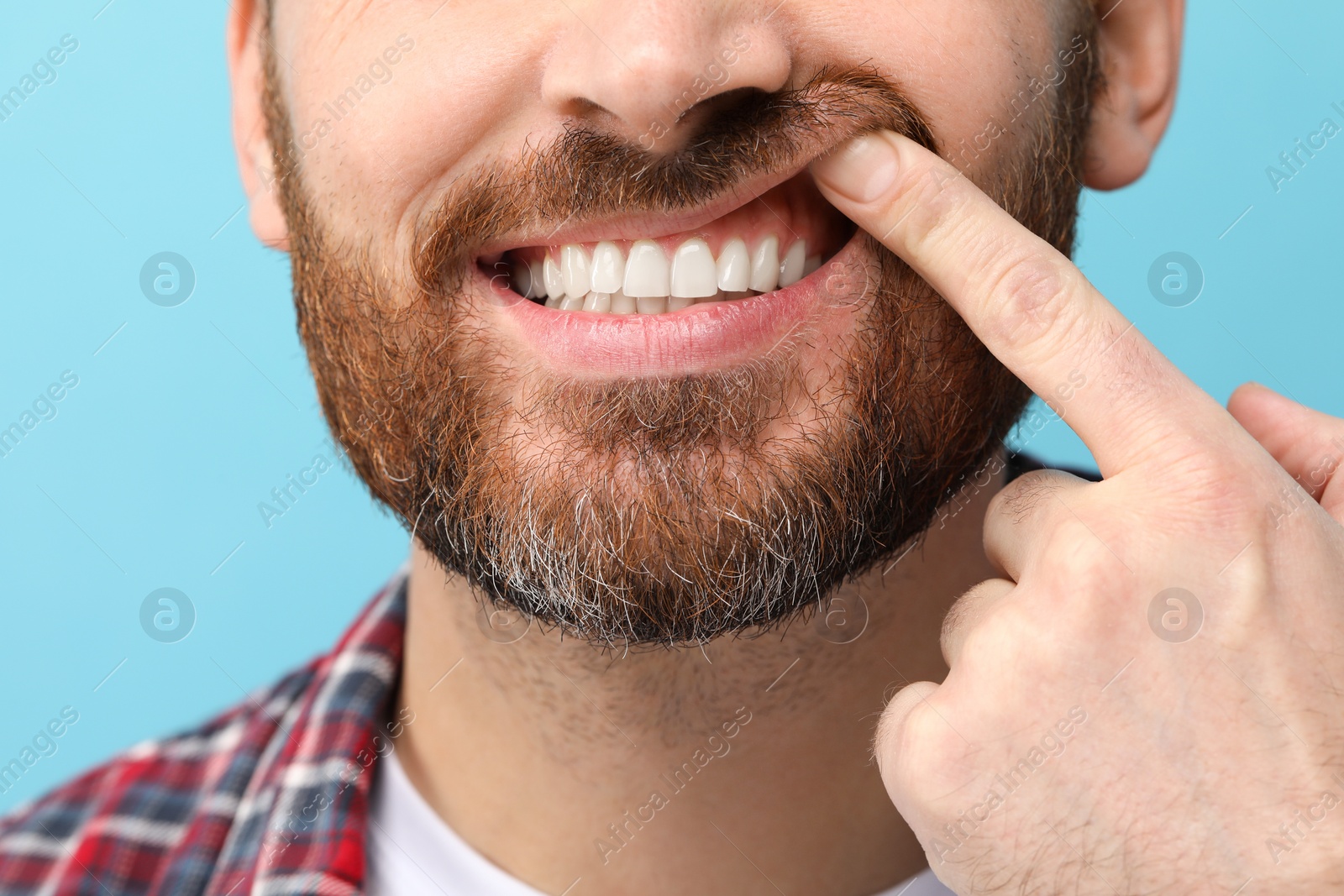 Photo of Man showing his healthy teeth and gums on light blue background, closeup