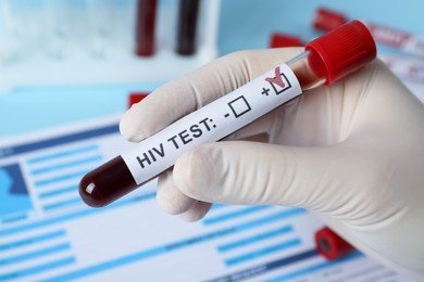 Photo of Scientist holding tube with blood sample and label HIV Test near laboratory form, closeup