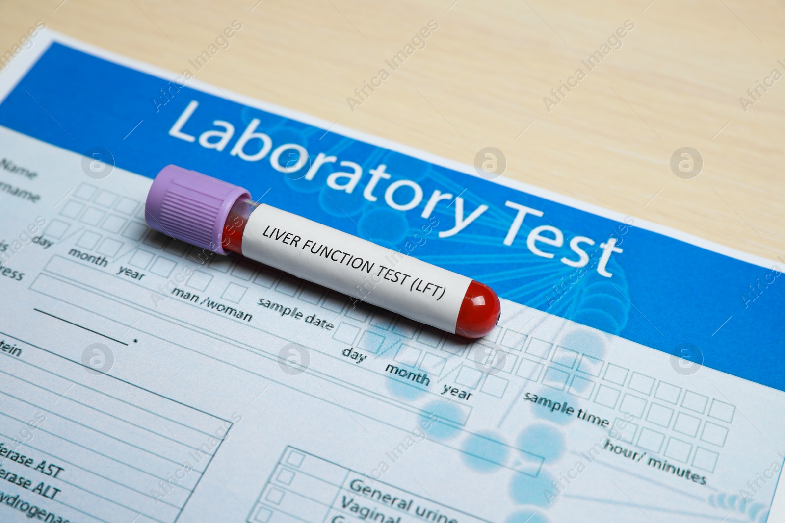 Photo of Liver Function Test. Tube with blood sample and laboratory form on wooden table